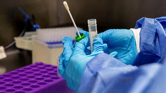 Новозаразените с коронавирус за денонощието са 3519 при направени общо 7934 PCR теста Това означава