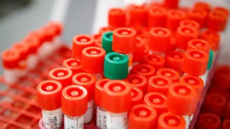 САЩ: Одобрен е първият кръвен тест за COVID-19, даващ резултат до 20 минути