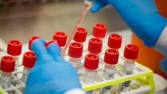 САЩ предлагат домашен молекулярен тест за коронавирус срещу $119