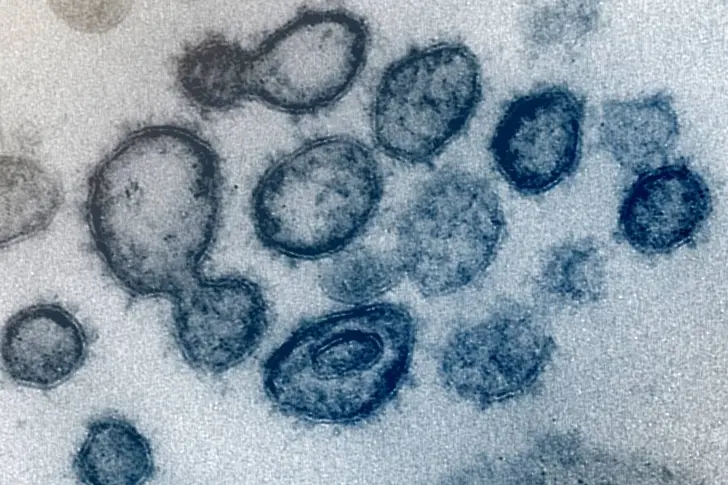 Потвърдените случаи на коронавирус за 24 часа скачат до 5,9% от пробите