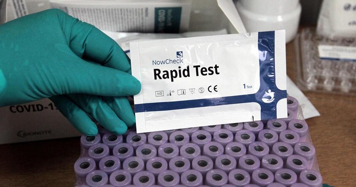 Направление за PCR тест ще се издава и на хора,