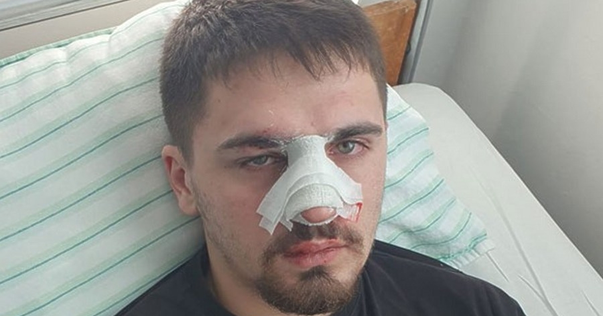 19-годишният младеж, за когото баща му твърди, че е пребит