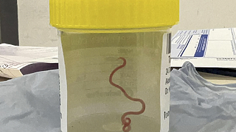 За първи път в света 8 сантиметров червей беше открит в мозъка