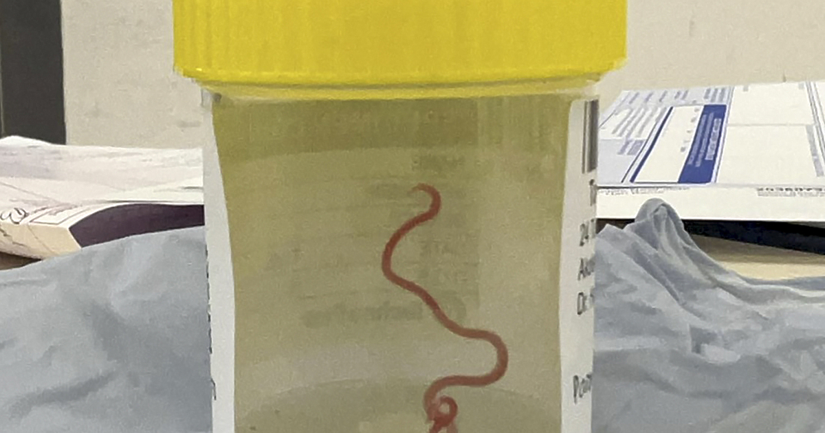 За първи път в света 8-сантиметров червей беше открит в мозъка