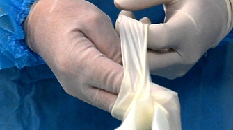 Първият в света пациент с трансплантиран свински бъбрек почина почти