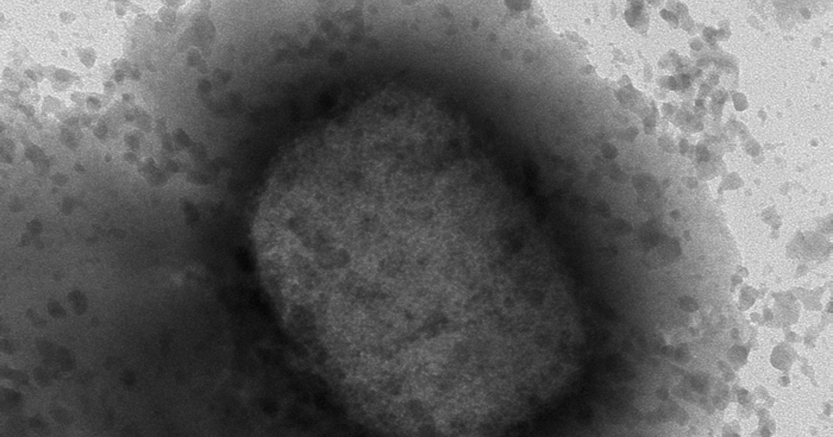 В София е потвърден случай на заболял от маймунска вариола.Това