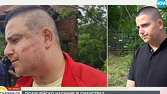 Мъж от Силистра твърди че е станал жертва на полицейско