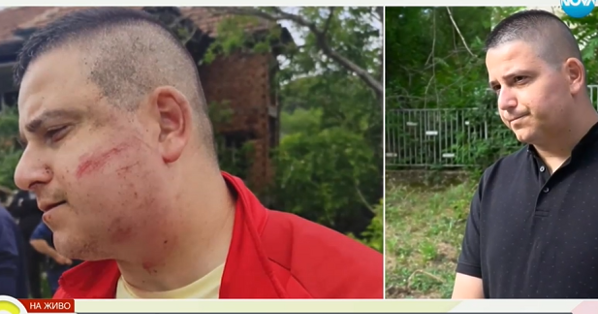 Мъж от Силистра твърди, че е станал жертва на полицейско